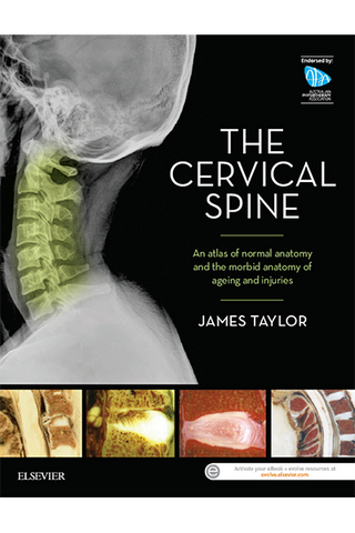 The Cervical Spine: An atlas of normal anatomy